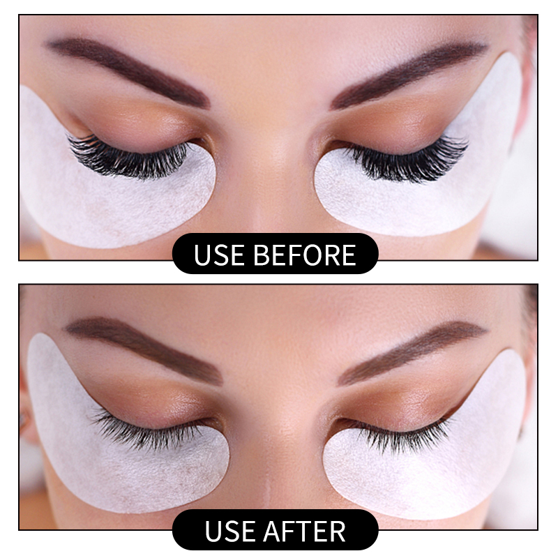 Removedor de pegamento para ex - Eyelash Extension Eye Irritation reseña y precio